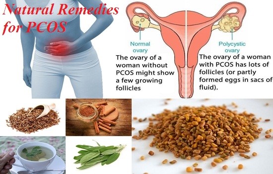 PCOS or PCOD Ayurvedic Home Remedies