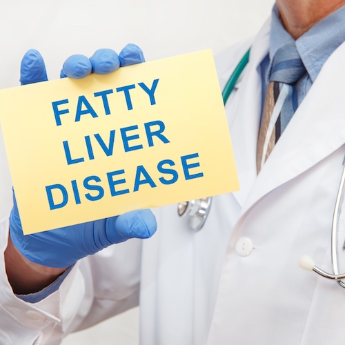 Fatty Liver in Ayurveda